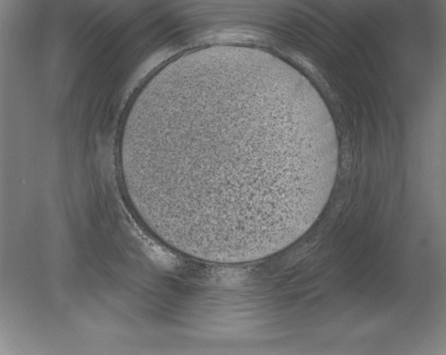 X0000079581086200612301400