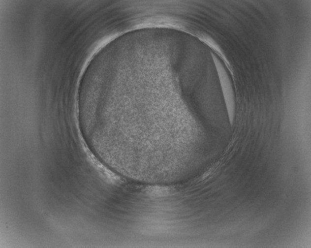 X0000079581088200612301400