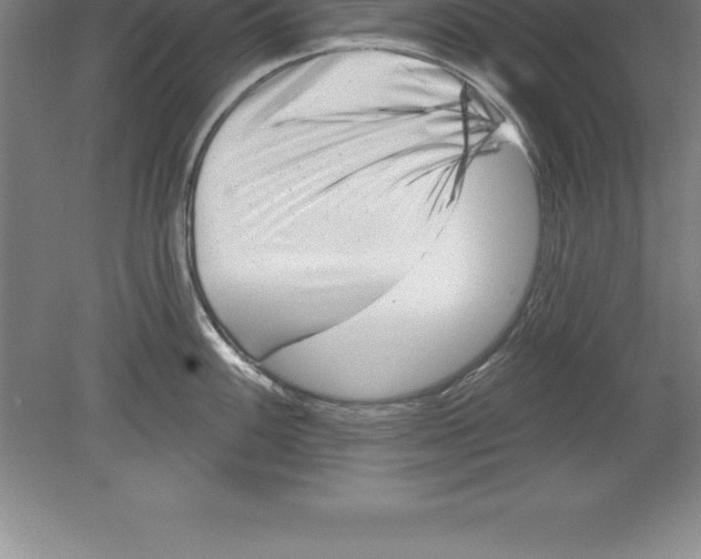 X0000079581100200612301400