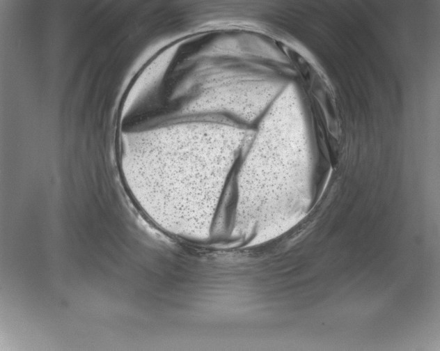 X0000079581102200612301400