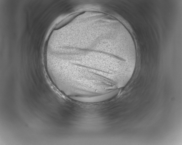 X0000079581104200612301400