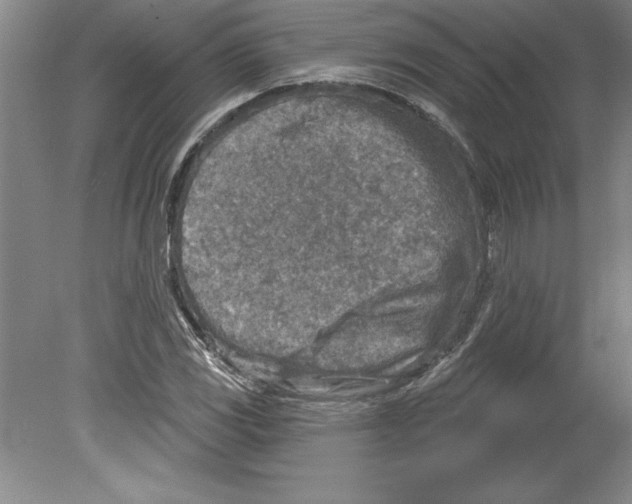 X0000079581117200612301359