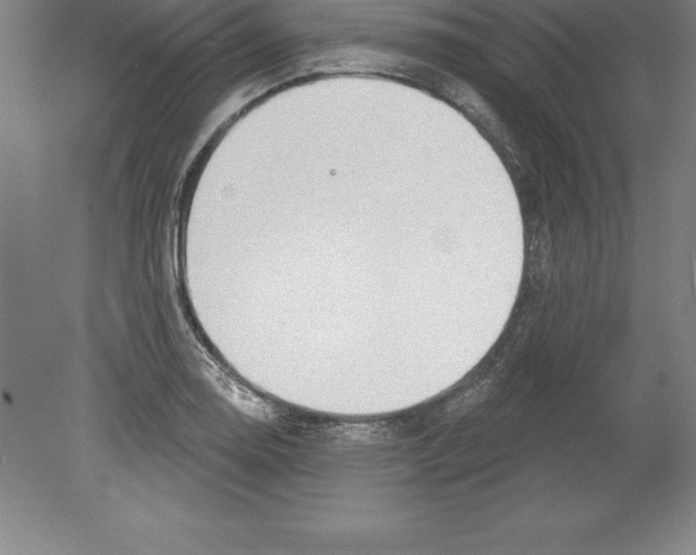 X0000079581130200612301400