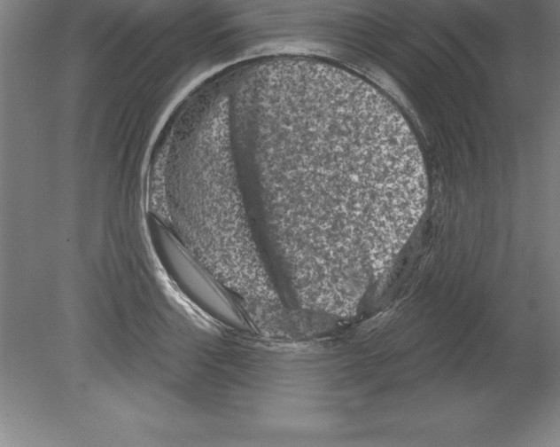 X0000079581132200612301400