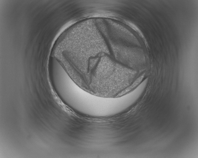 X0000079581138200612301400