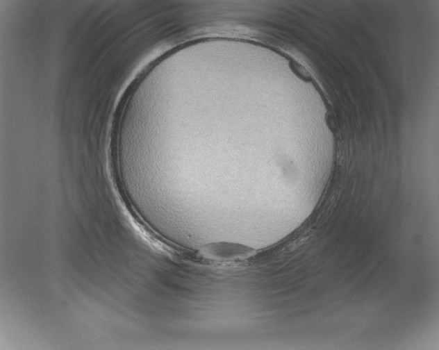 X0000079581139200612301400