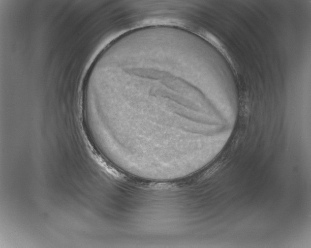 X0000079581140200612301400