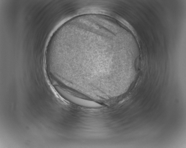 X0000079581144200612301400