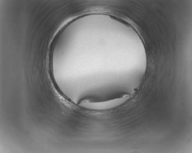 X0000079581147200612301400