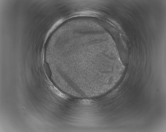 X0000079581180200612301359