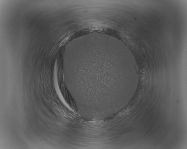 X0000080100916200612151617