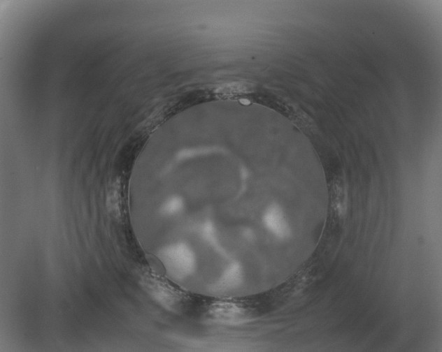 X0000080110519200612151650