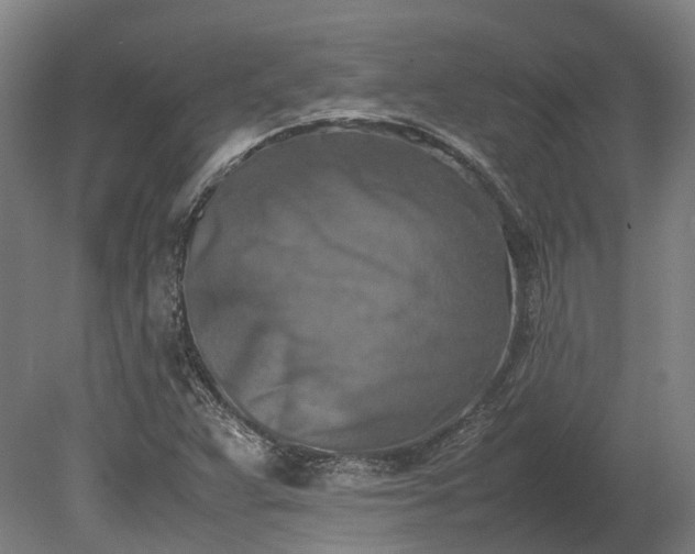 X0000080111359200612151636