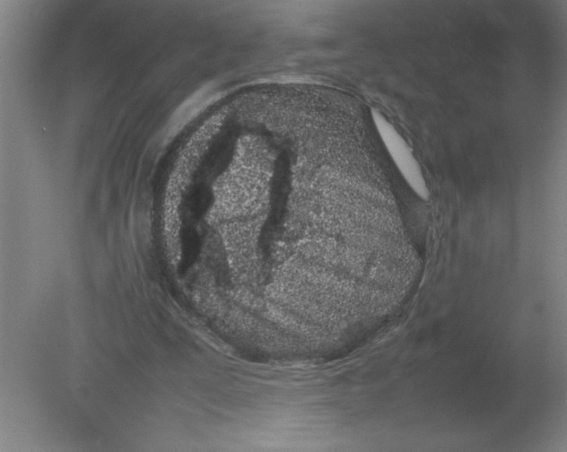 X0000080120295200612302017