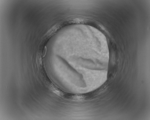 X0000080120313200612302017