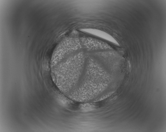 X0000080120331200612302017