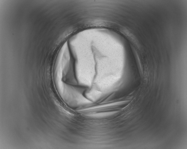 X0000080120394200612302016