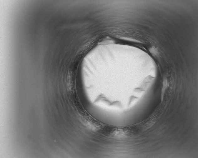 X0000080140416200612302107