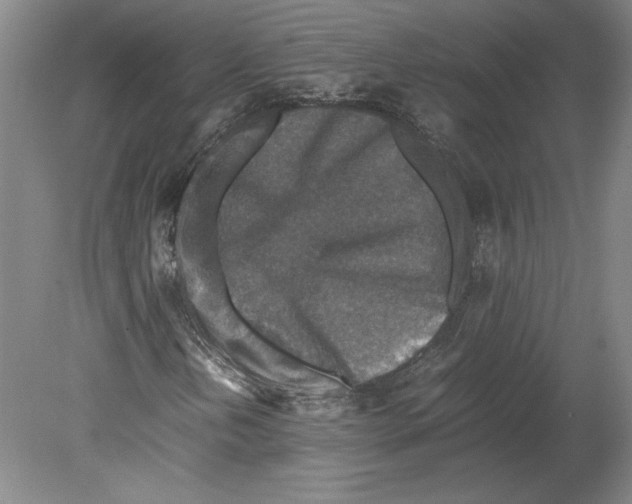 X0000080141202200701051504