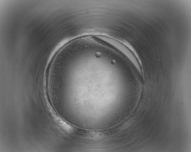 X0000080151096200612081315