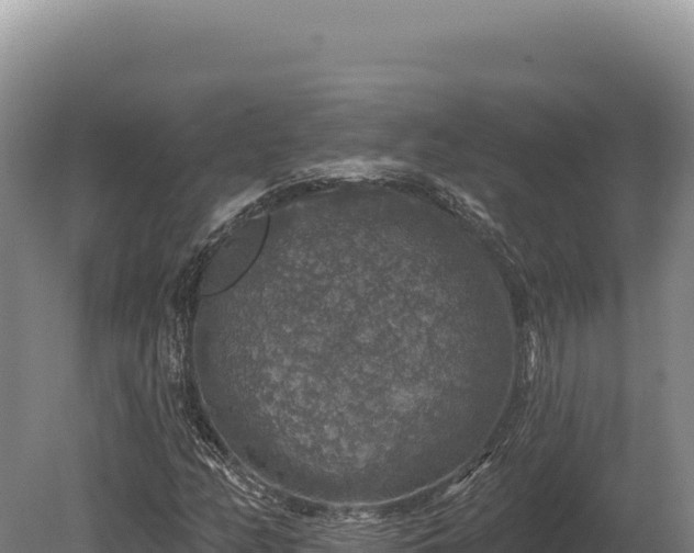 X0000080151158200612151823