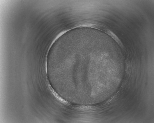 X0000080151036200612221944