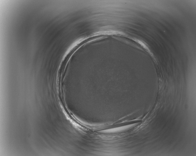 X0000080151046200612221944