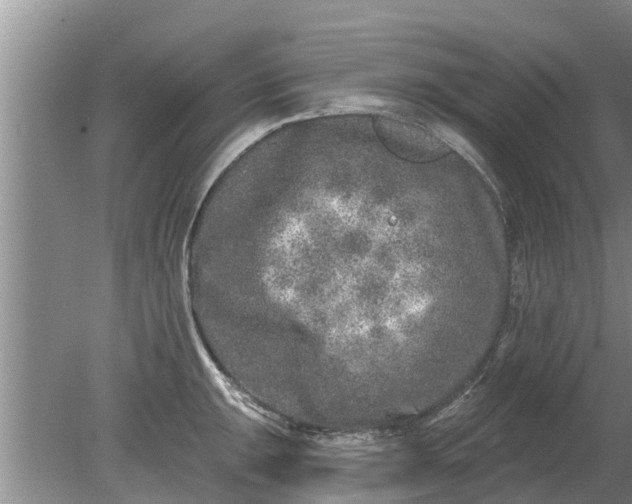 X0000080151047200612221944