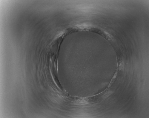 X0000080151156200612221942