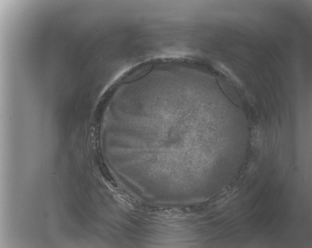 X0000080151208200612221940