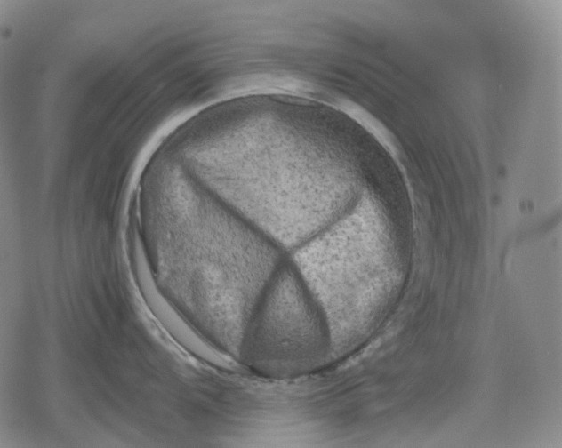 X0000080161104200612221220