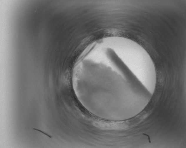 X0000080160036200612302205