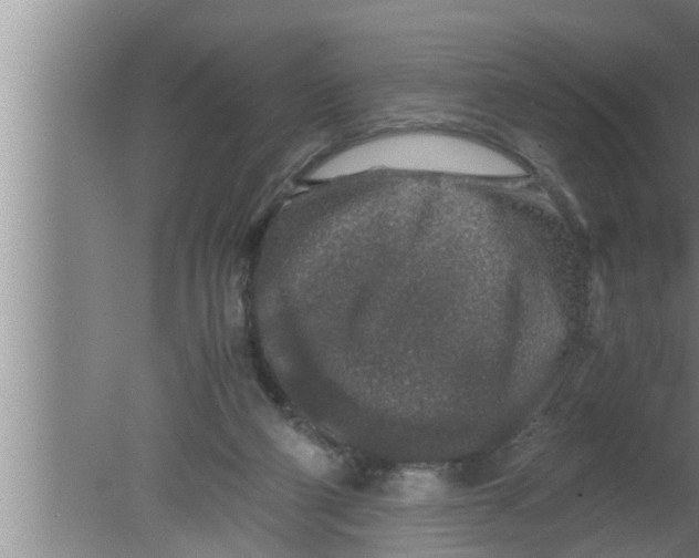 X0000080160114200612302203