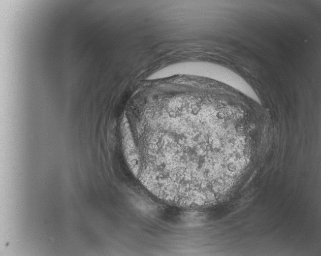 X0000080160319200612302200