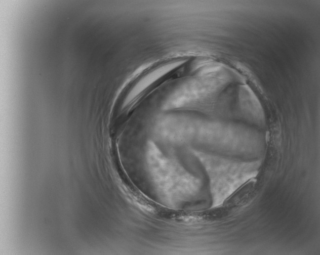 X0000080160395200612302159