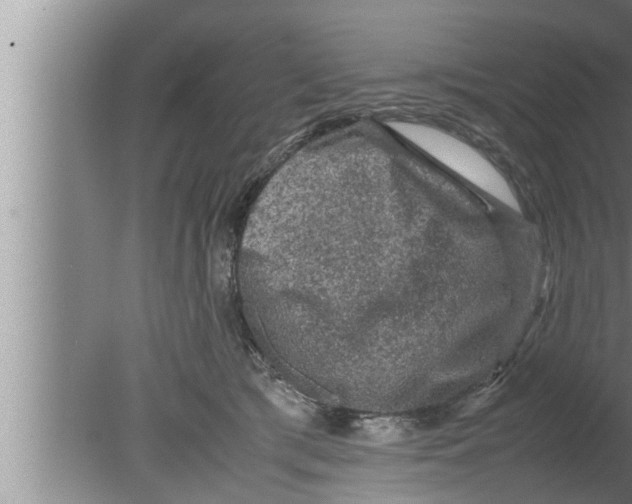 X0000080160417200612302158