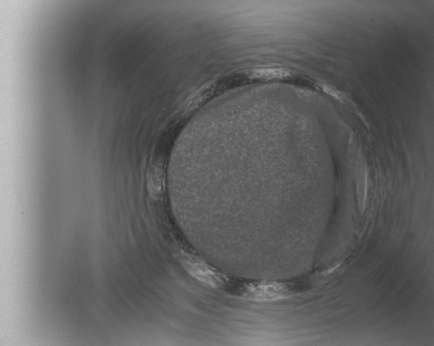 X0000080160517200612302157