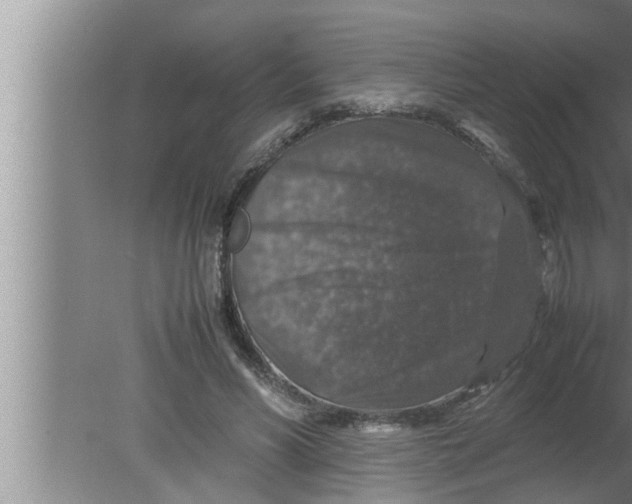 X0000080160590200612302155