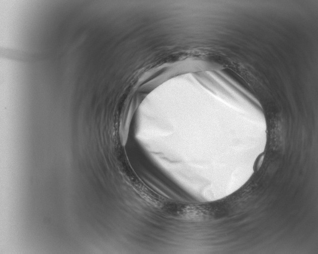 X0000080160608200612302155