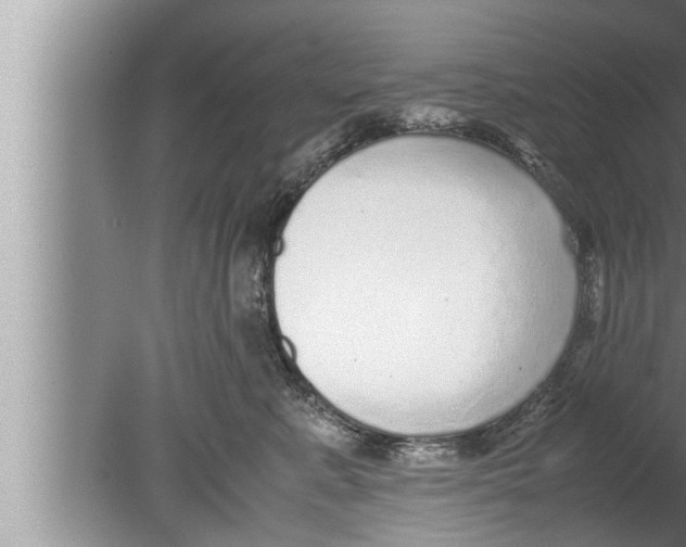 X0000080160619200612302155