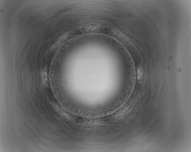 X0000080171011200612081355