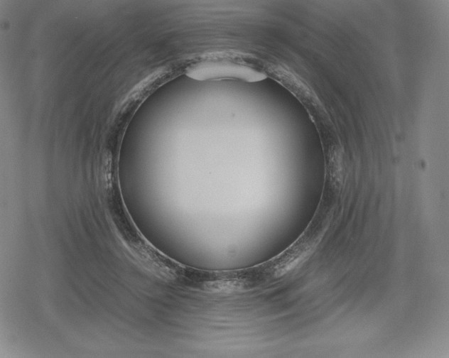 X0000080170356200612221256