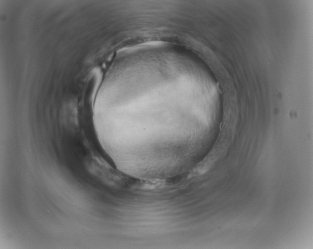 X0000080170720200612221251