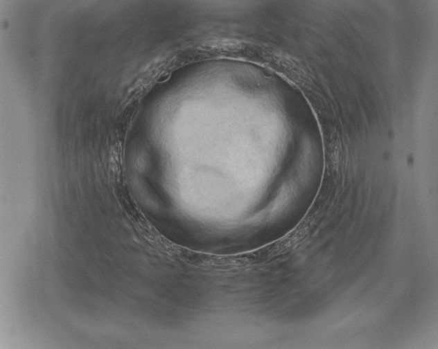 X0000080171397200612221239