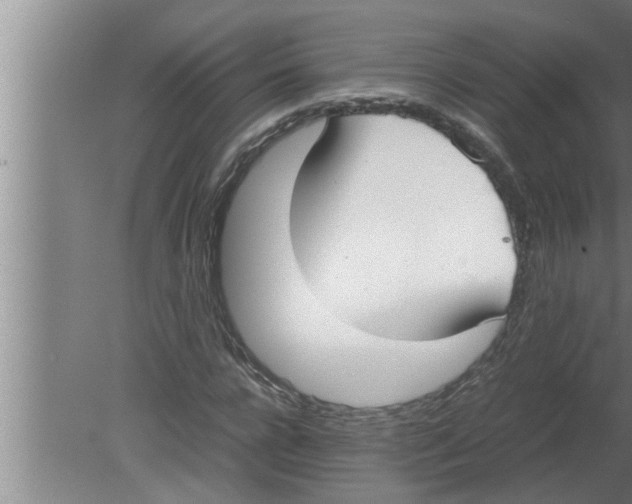 X0000080170920200612302215