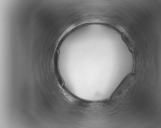 X0000080171181200612302211