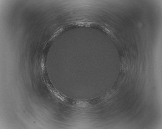 X0000080181154200612081354