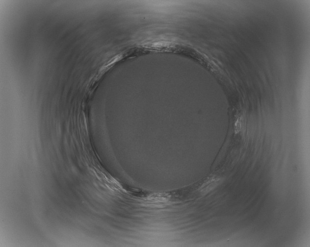 X0000080181156200612081354