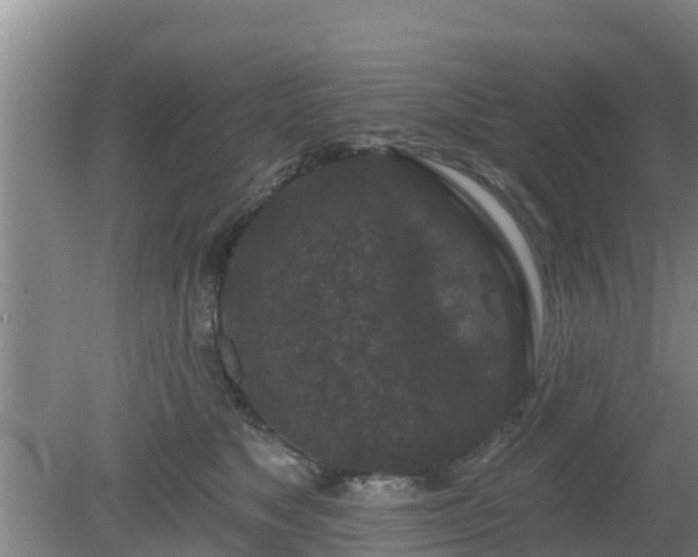 X0000080180517200612151952