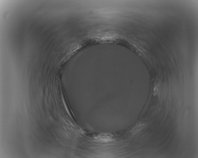 X0000080181156200612151941